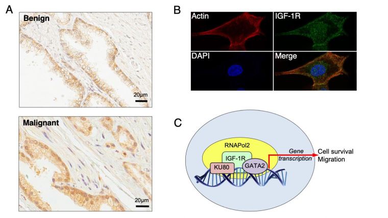 Nuclear IGF-1R binds regulatory regions of DNA, promoting expression of genes that drive tumour cell survival and migration.